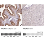 Anti-PRDX5 Antibody