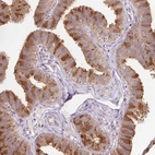 Immunohistochemical staining of human fallopian tube shows high expression.