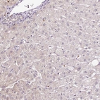 Immunohistochemical staining of human liver shows low expression as expected.