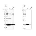 Western blot analysis using Anti-PRDX5 antibody HPA037916 (A) shows similar pattern to independent antibody HPA037915 (B).
