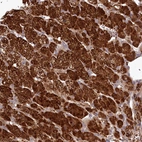 Immunohistochemical staining of human adrenal gland shows strong cytoplasmic positivity in glandular cells.