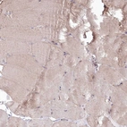 Immunohistochemical staining of human skeletal muscle shows moderate cytoplasmic positivity in myocytes.