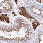 Immunohistochemical staining of human testis shows strong cytoplasmic positivity in Leydig cells.
