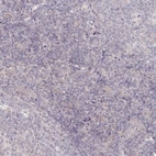 Immunohistochemical staining of human tonsil shows no positivity in non-germinal center cells as expected.