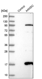 Western blot analysis in control (vector only transfected HEK293T lysate) and AAMDC over-expression lysate (Co-expressed with a C-terminal myc-DDK tag (~3.1 kDa) in mammalian HEK293T cells, LY411144).