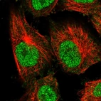 Immunofluorescent staining of human cell line U-251 MG shows localization to nucleoplasm.