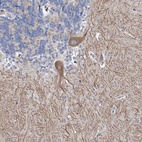 Anti-ANKRD16 Antibody