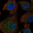 Immunofluorescent staining of human cell line A549 shows localization to endoplasmic reticulum.