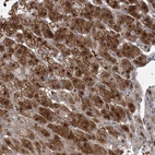 Immunohistochemical staining of human adrenal gland shows strong cytoplasmic positivity in glandular cells.