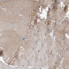 Immunohistochemical staining of human skeletal muscle shows moderate cytoplasmic positivity in myocytes.