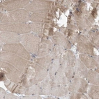 Immunohistochemical staining of human skeletal muscle shows moderate cytoplasmic positivity in myocytes.