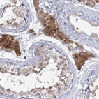 Immunohistochemical staining of human testis shows strong cytoplasmic positivity in Leydig cells.