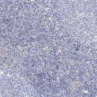 Immunohistochemical staining of human tonsil shows no positivity in non-germinal center cells as expected.