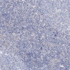 Immunohistochemical staining of human tonsil shows no positivity in non-germinal center cells as expected.