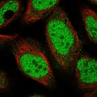 Immunofluorescent staining of human cell line U-2 OS shows localization to nucleoplasm.