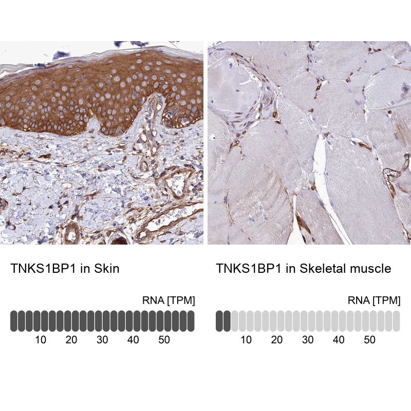 Anti-TNKS1BP1 Antibody