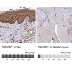 Anti-TNKS1BP1 Antibody