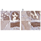 Immunohistochemical staining of human kidney, prostate, skeletal muscle and skin using Anti-TNKS1BP1 antibody HPA037929 (A) shows similar protein distribution across tissues to independent antibody HPA037930 (B).