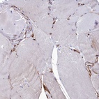 Immunohistochemical staining of human skeletal muscle shows low expression as expected.