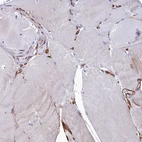 Immunohistochemical staining of human skeletal muscle shows low expression as expected.