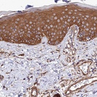 Immunohistochemical staining of human skin shows high expression.