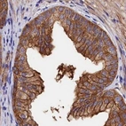 Immunohistochemical staining of human prostate using Anti-TNKS1BP1 antibody HPA037929.