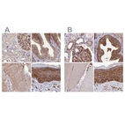 Immunohistochemical staining of human kidney, prostate, skeletal muscle and skin using Anti-TNKS1BP1 antibody HPA037930 (A) shows similar protein distribution across tissues to independent antibody HPA037929 (B).