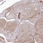 Immunohistochemical staining of human skeletal muscle shows low expression as expected.