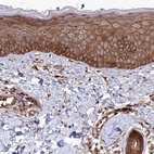 Immunohistochemical staining of human skin shows high expression.