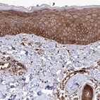 Immunohistochemical staining of human skin shows high expression.