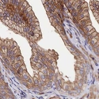 Immunohistochemical staining of human prostate using Anti-TNKS1BP1 antibody HPA037930.