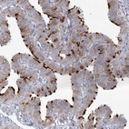 Anti-ENO4 Antibody