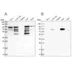 Anti-SHTN1 Antibody