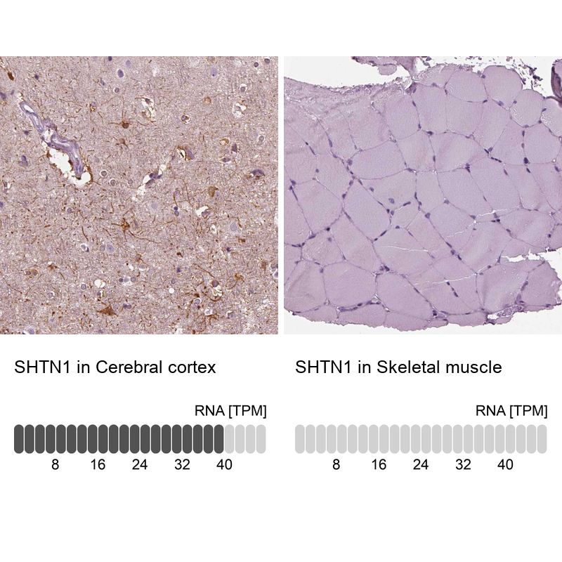 Anti-SHTN1 Antibody
