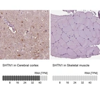 Anti-SHTN1 Antibody