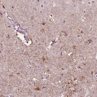 Immunohistochemical staining of human cerebral cortex shows strong cytoplasmic positivity in glial cells.