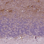 Immunohistochemical staining of human cerebellum shows strong positivity in neuronal processes in white matter.