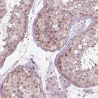 Immunohistochemical staining of human testis shows weak cytoplasmic positivity in spermatogonia.