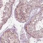 Immunohistochemical staining of human testis shows weak cytoplasmic positivity in spermatogonia.