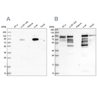 Western blot analysis using Anti-SHTN1 antibody HPA037942 (A) shows similar pattern to independent antibody HPA037943 (B).