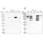 Western blot analysis using Anti-SHTN1 antibody HPA037942 (A) shows similar pattern to independent antibody HPA037943 (B).