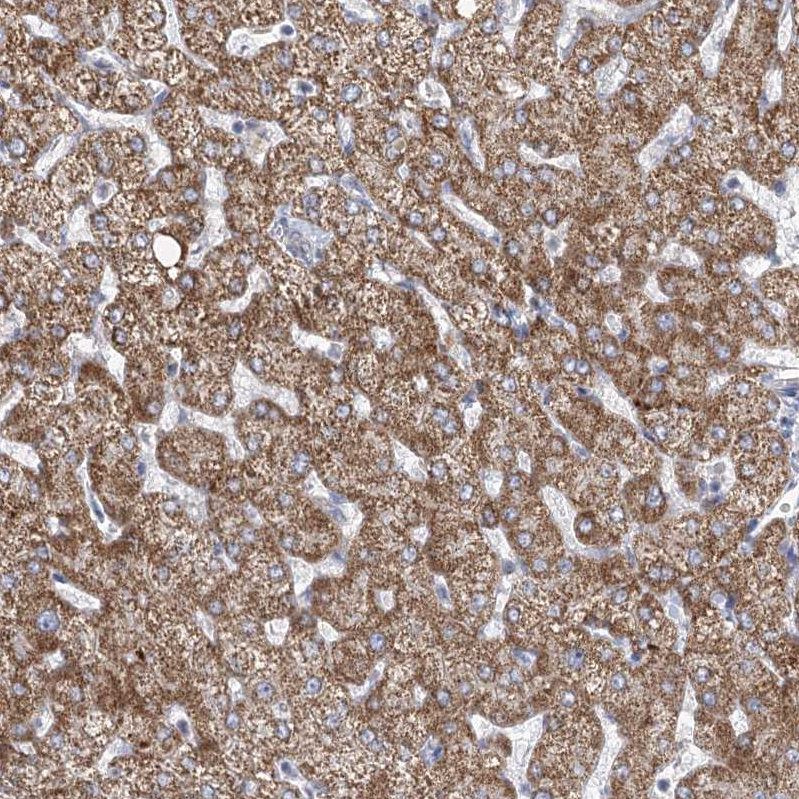 Anti-DHTKD1 Antibody