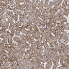 Anti-DHTKD1 Antibody