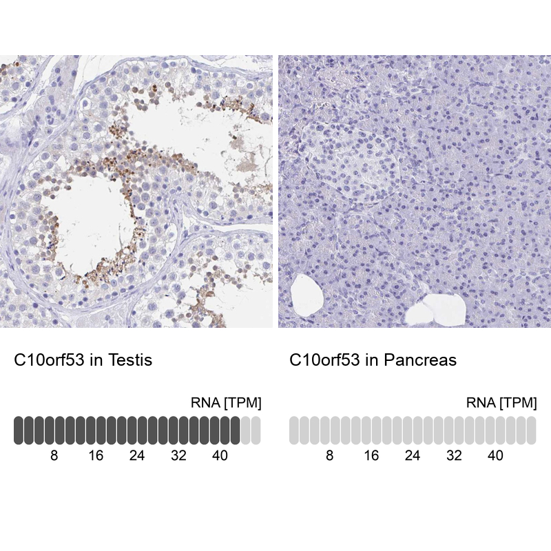 Anti-C10orf53 Antibody