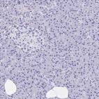 Immunohistochemical staining of human pancreas shows low expression as expected.