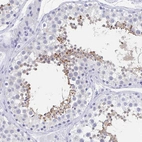 Immunohistochemical staining of human testis shows high expression.