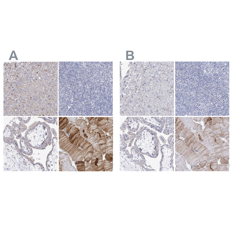 Anti-NRAP Antibody
