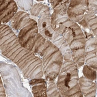 Immunohistochemical staining of human skeletal muscle shows moderate to strong cytoplasmic positivity in myocytes.