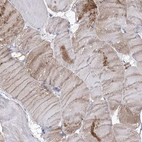 Immunohistochemical staining of human skeletal muscle shows moderate cytoplasmic positivity in myocytes.