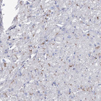 Immunohistochemical staining of human heart muscle shows moderate positivity in intercalated discs in myocytes.